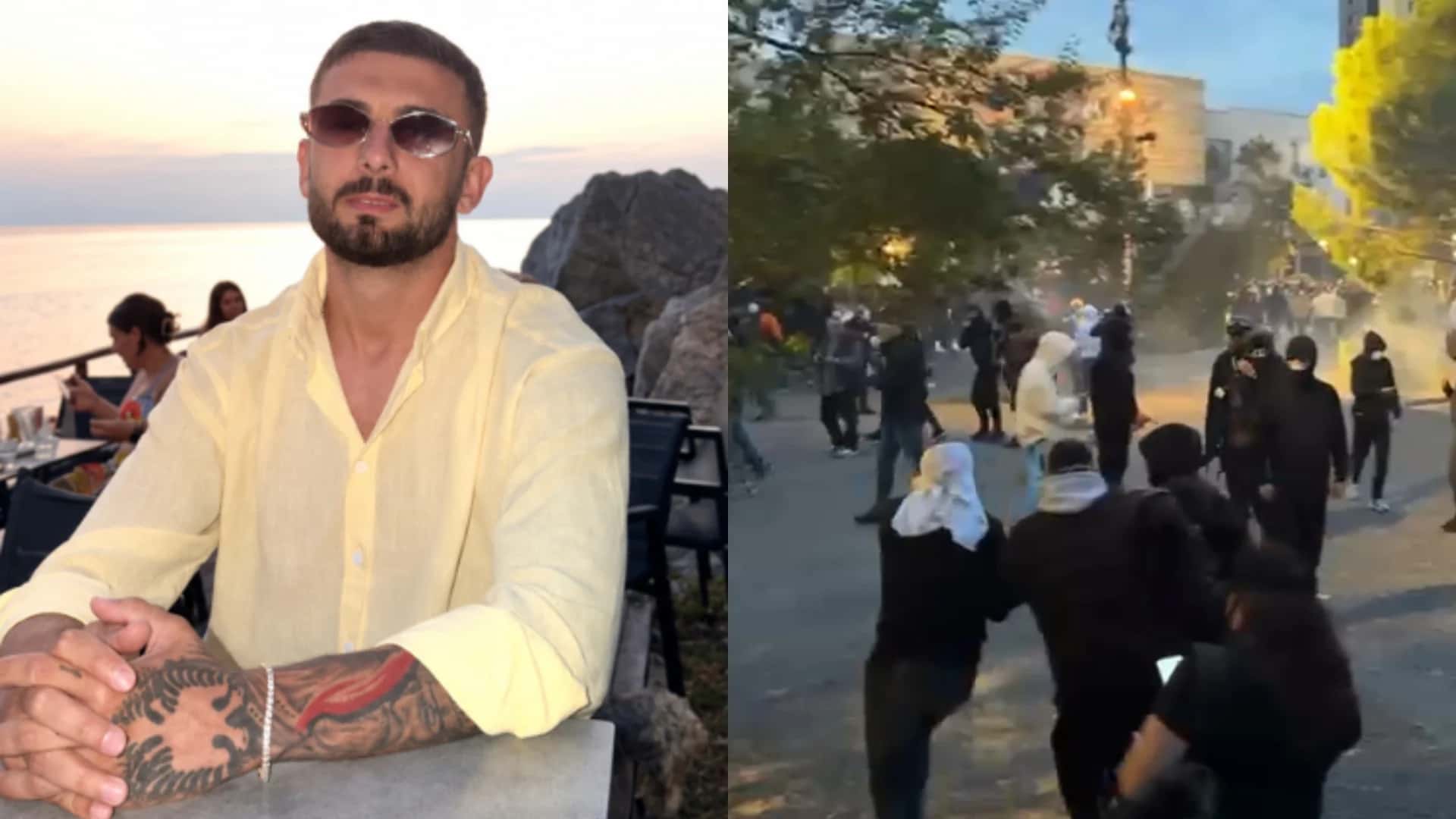 He was hit with rubber bullets in his eye during the protest, Erjon Vecke undergoes the first operation