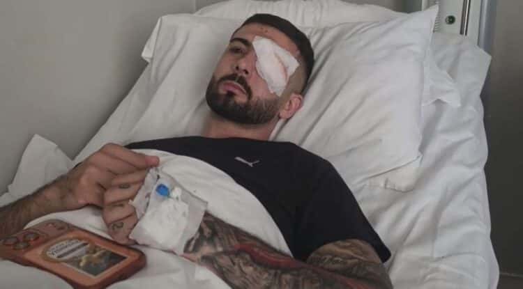He was shot with rubber bullets in his eye, Vishku: I was 30 meters away from effective, I wasn’t doing anything.