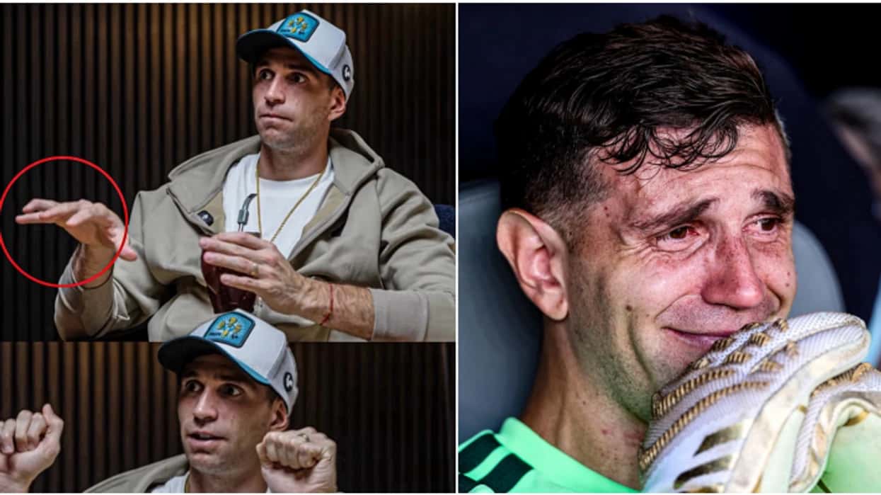 He played a broken finger in the World, the silversmith discovers permanent consequences