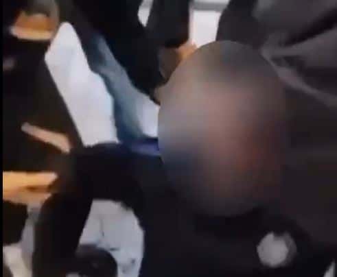 A police officer suspended in Albania after allegedly hitting a protester’s eye with rubber bullet