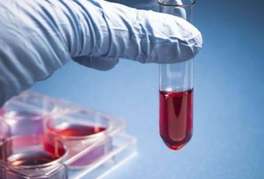 Should you be sober before blood sugar is tested?