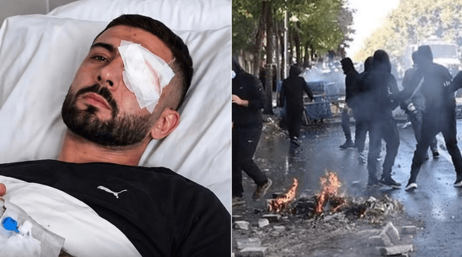 Suspectedly hit with rubber bullets in the eye, prosecution launches investigations into 28-year-old wound in Tirana protest