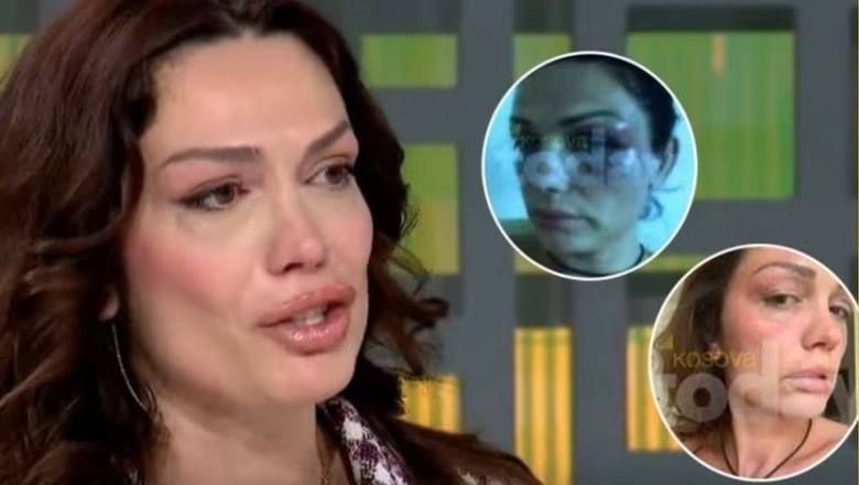Drenusha Latifi ia përplas në fytyrë Edona Llalloshit: Kur ti kërkove mbrojtje, institucionet vepruan e burri yt u arrestua disa herë