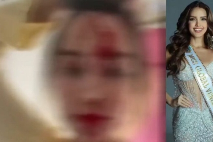 Fytyra e mbuluar me gjak, dhunohet “Miss Venezuela”, arrestohet stilisti i njohur
