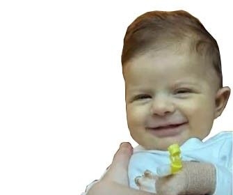 Apel për ndihmë: Hana 2 muajshe e gjysmë ka nevojë urgjente për shërim jashtë vendit