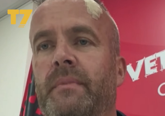 Flet Hysni Mehani në T7: Veç e kam pa Sami Lushtakun që më është afruar dhe më goditi me telefon
