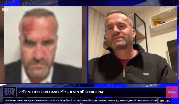 Mehani e quan kriminel Lushtakun thotë se e ka marrë peng Policinë dhe gjithë qytetin e Skenderajt Mehani e quan kriminel Lushtakun thotë se e ka marrë peng Policinë dhe gjithë qytetin e Skenderajt